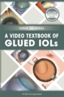 A Video Textbook of Glued IOLs - eBook