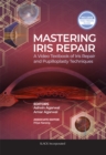 Mastering Iris Repair : A Video Textbook of Iris Repair and Pupilloplasty Techniques - Book