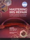 Mastering Iris Repair : A Video Textbook of Iris Repair and Pupilloplasty Techniques - eBook