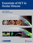 Essentials of OCT in Ocular Disease - eBook