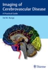 Imaging of Cerebrovascular Disease : A Practical Guide - eBook