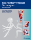 Neurointerventional Techniques : Tricks of the Trade - eBook