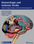 Hemorrhagic and Ischemic Stroke : Medical, Imaging, Surgical and Interventional Approaches - eBook