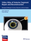 Video Atlas of Anterior Segment Repair and Reconstruction : Managing Challenges in Cornea, Glaucoma, and Lens Surgery - Book