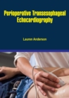 Perioperative Transesophageal Echocardiography - eBook