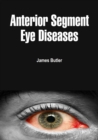 Anterior Segment Eye Diseases - eBook