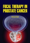 Focal Therapy in Prostate Cancer - eBook