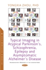 Typical Imaging in Atypical Parkinson's, Schizophrenia, Epilepsy and Asymptomatic Alzheimer's Disease - eBook