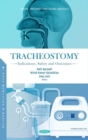 Tracheostomy : Indications, Safety and Outcomes - Book