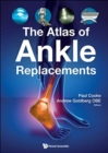 Atlas Of Ankle Replacements, The - Book