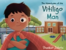 The Adventures of The Vitiligo Man - Book