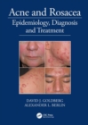 Acne and Rosacea : Epidemiology, Diagnosis and Treatment - Book