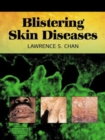 Blistering Skin Diseases - Book
