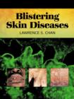 Blistering Skin Diseases - eBook