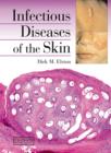 Infectious Diseases of the Skin - eBook