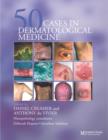 Fifty Dermatological Cases - Book