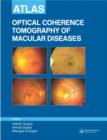 Atlas of Optical Coherence Tomography of Macular Diseases - Book