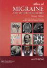 Atlas of Migraine and Other Headaches - Book