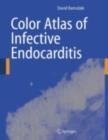 Color Atlas of Infective Endocarditis - eBook
