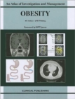 Obesity - Book