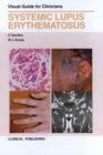 Systemic Lupus Erythematosus : Visual Guide for Clinicians - Book