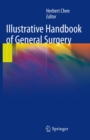 Illustrative Handbook of General Surgery - eBook