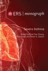Severe Asthma - eBook