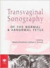 Transvaginal Sonography of the Normal and Abnormal Fetus - Book