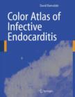 Color Atlas of Infective Endocarditis - Book