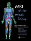 MRI of the Whole Body : An Illustrated Guide for Common Pathologies - Book