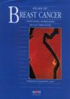 Atlas of Breast Cancer - Book