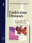 Endocrine Diseases - Book