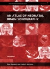 An Atlas of Neonatal Brain Sonography - Book