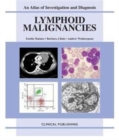 Lymphoid Malignancies : v. 1 - Book
