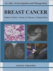 Breast Cancer - Book