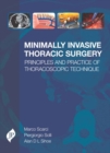 Minimally Invasive Thoracic Surgery : Principles and Practice of Thoracoscopic Technique - Book