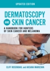 Dermatoscopy and Skin Cancer, updated edition : A handbook for hunters of skin cancer and melanoma - eBook