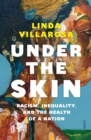 Under the Skin : racism, inequality, and the health of a nation - eBook