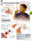 Understanding Asthma Laminated Poster - Book