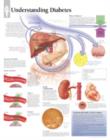 Understanding Diabetes Laminated Poster - Book