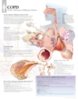 COPD (Chronic Obstructive Pulmonary Disease) Paper Poster - Book