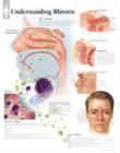 Understanding Rhinitis Laminated Poster - Book