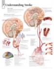 Understanding Stroke Laminated Poster - Book