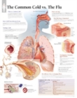 Common Cold vs the Flu Paper Poster - Book