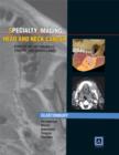 Specialty Imaging: Head & Neck Cancer : State of the Art Diagnosis, Staging, and Surveillance - Book