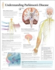 Understanding Parkinson's Laminated Poster - Book