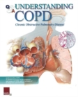 Understanding COPD Flip Chart - Book