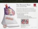 Life Size Diseased Heart Model - Book