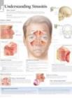 Understanding Sinusitis Laminated Poster - Book