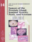 Tumors of the Prostate Gland, Seminal Vesicles, Penis, and Scrotum - Book